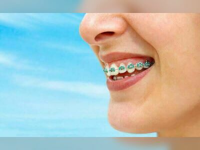 T Smile Dental Clinic Lampang