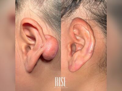 RISE Clinic