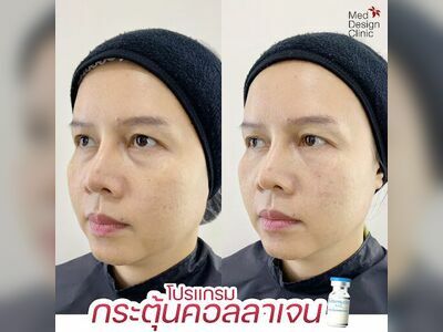 Med Design Clinic - Rayong Branch