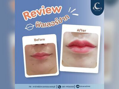 Caraclinic (คาร่าคลินิกความงามเพชรบุรี)