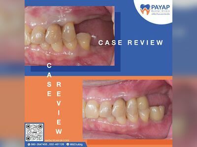 Phayap Dental Clinic, Phetchaburi