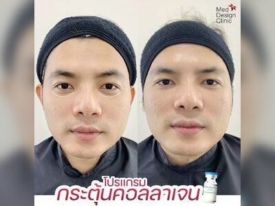 Med Design Clinic - Rayong Branch