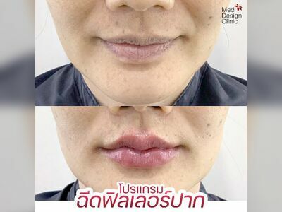 Med Design Clinic - Rayong Branch