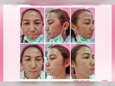 Cleo Skin Udon Thani