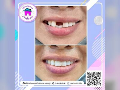 Baan Yim Suay Dental Clinic, Phetchaburi