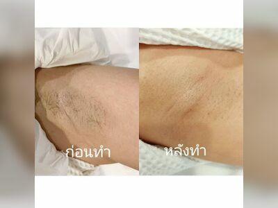 ISM Clinic Nong Khai