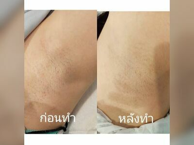 ISM Clinic Nong Khai
