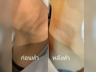 ISM Clinic Nong Khai