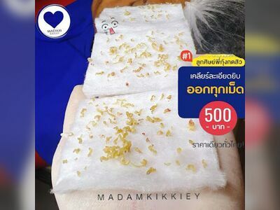 Pee Kung Acne Extraction Nong Khai
