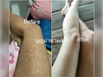 Boonnampha Traditional Thai Medicine Clinic