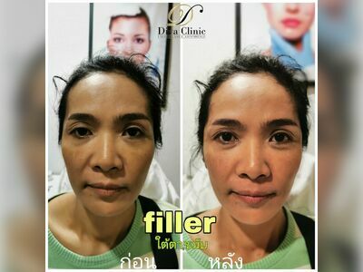 DIVA Clinic Chumphon