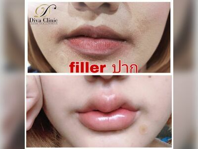 DIVA Clinic Chumphon
