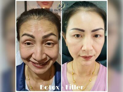 DIVA Clinic Chumphon
