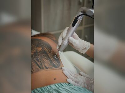 Inked Out Tattoo Remover