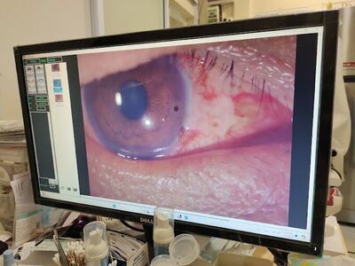 Sukanya Eye Clinic