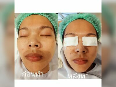 ISM Clinic Nong Khai