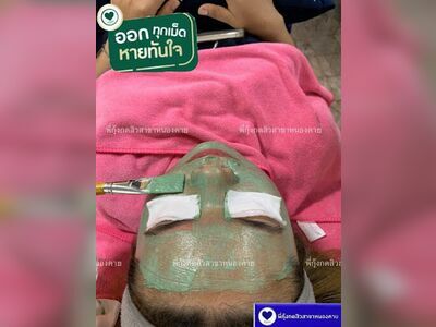Pee Kung Acne Extraction Nong Khai
