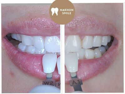 Nakhon Smile Dental Clinic