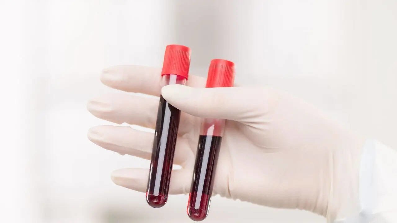 Rare Hybrid Blood Type Identified in Thailand Highlights Gaps in Global Blood Typing Systems