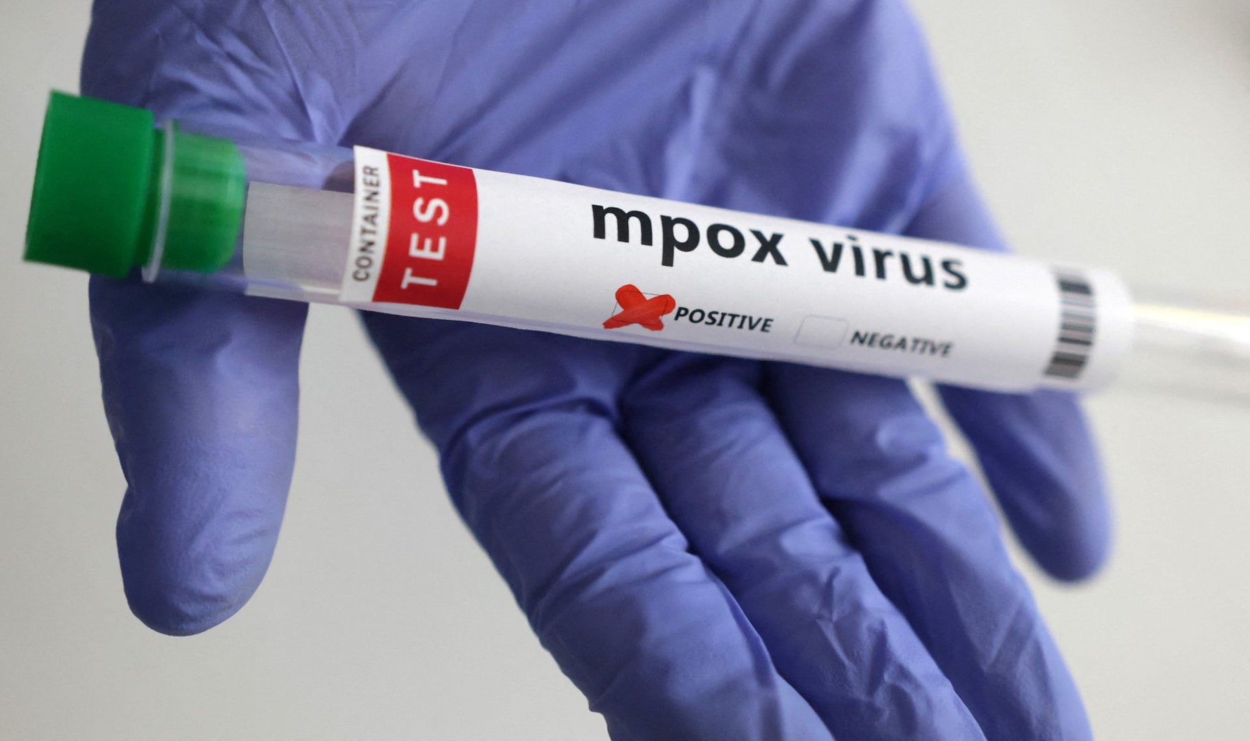 Thailand Expands Mpox Clade Ib Surveillance After Detecting Two New Cases